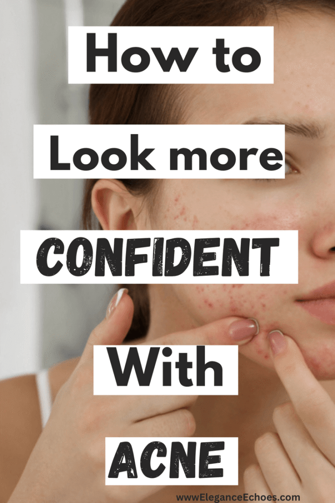 how to look more confident with acne 